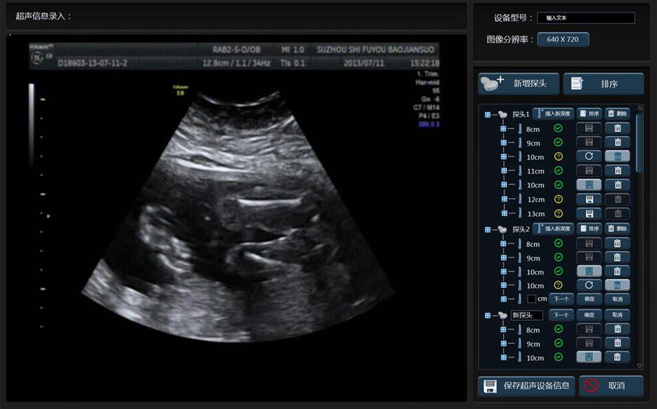 武漢睿影醫(yī)療科技超聲系統(tǒng)軟件界面設(shè)計