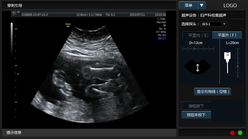 武漢睿影醫(yī)療科技超聲系統(tǒng)軟件界面設(shè)計