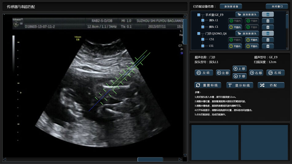 武漢睿影醫(yī)療科技超聲系統(tǒng)軟件界面設(shè)計